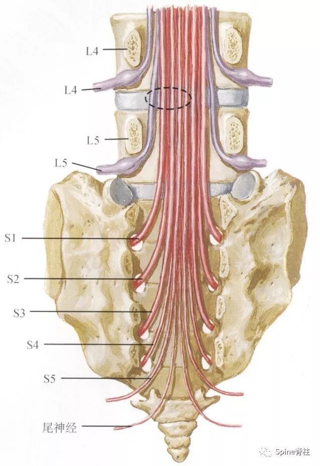 腰椎间盘突出下肢放射痛严重吗,下肢放射疼痛是间断性严重吗