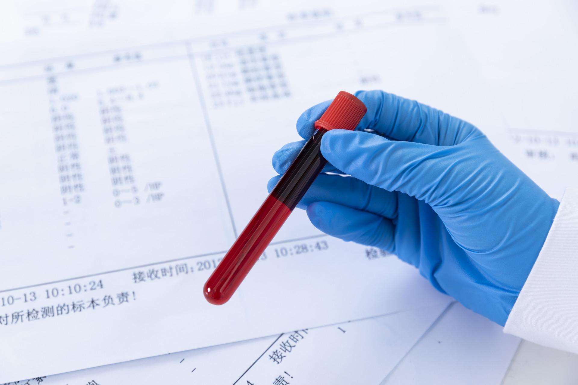老人血糖控制太严格容易低血糖,老年人血糖高要吃什么药