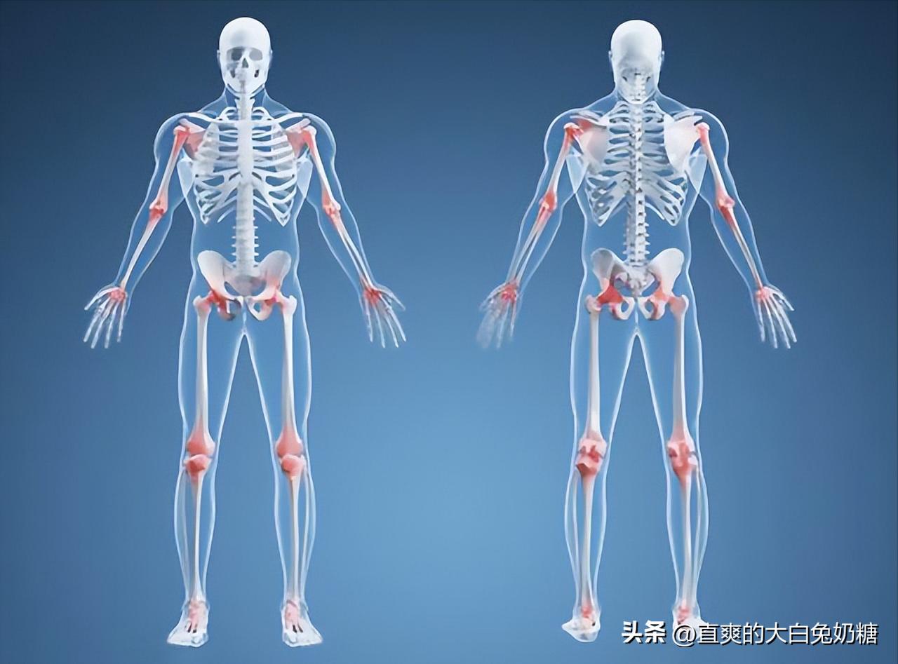 李亚诺断骨增高怎样了,断骨增高手术的李亚诺现状