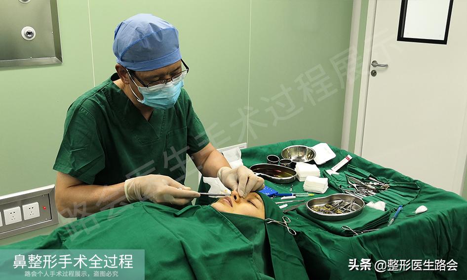 隆鼻手术全过程女生,隆鼻手术到底是怎么进行的