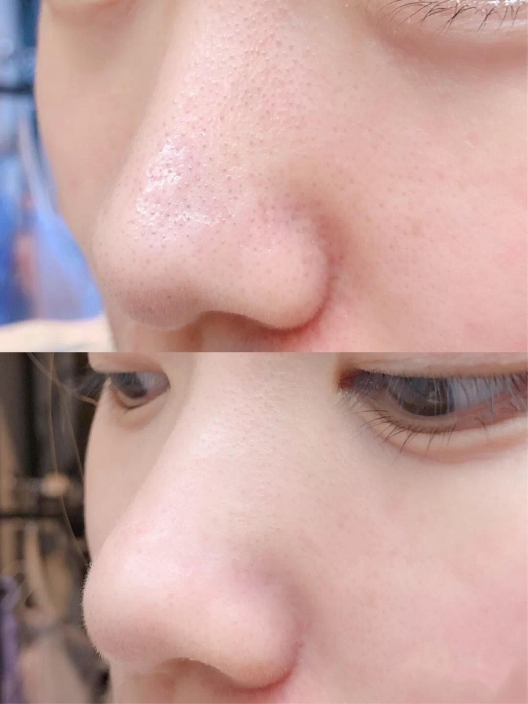 韩国vidivici女神洗面奶好用吗,vidivici洗面奶为啥叫小香奈儿