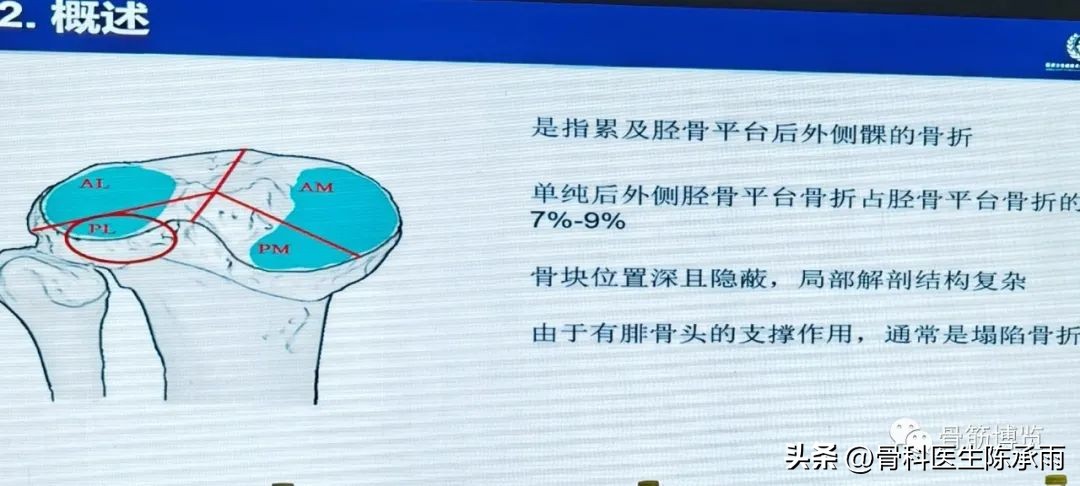 国家卫健委主办的骨创伤专项能力培训项目----下肢损伤学习班