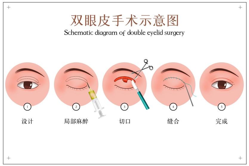 做完医美术后注意事项,医美术后恢复过程