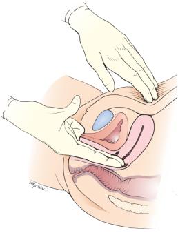 体检妇科不过怎么办,体检中哪些妇科病不用治