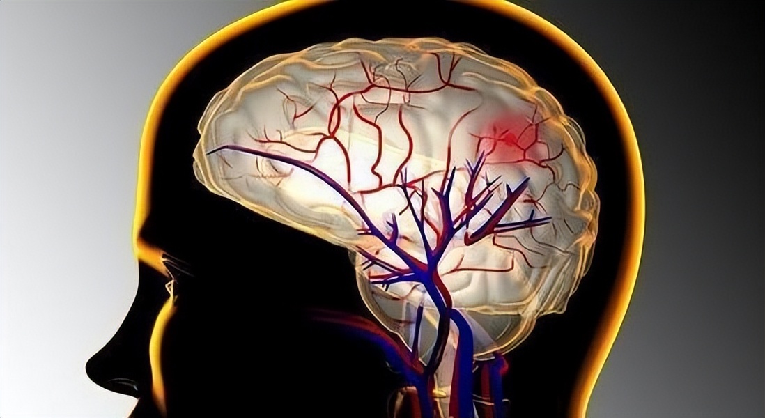 中风与脑梗有区别吗,中风和脑梗的区别在哪里