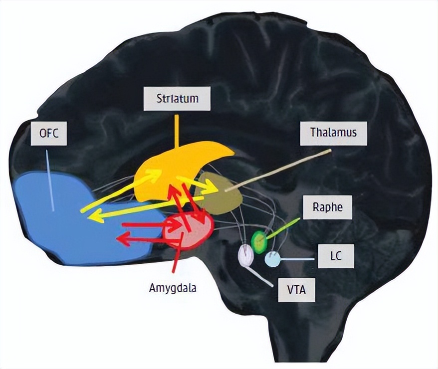 强迫障碍临床表现,强迫障碍最好治疗方法