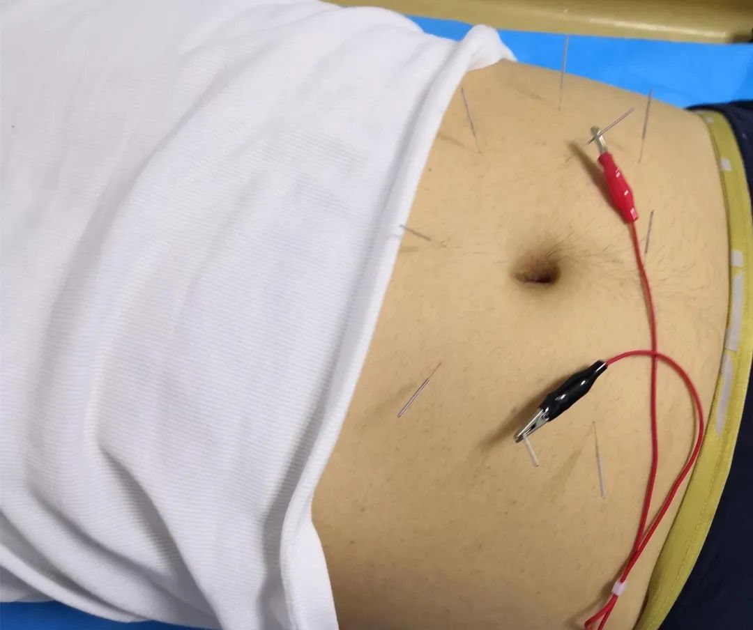 蛋蛋偶尔会发炎会影响生育吗,单侧睾丸静脉曲张会影响生育吗