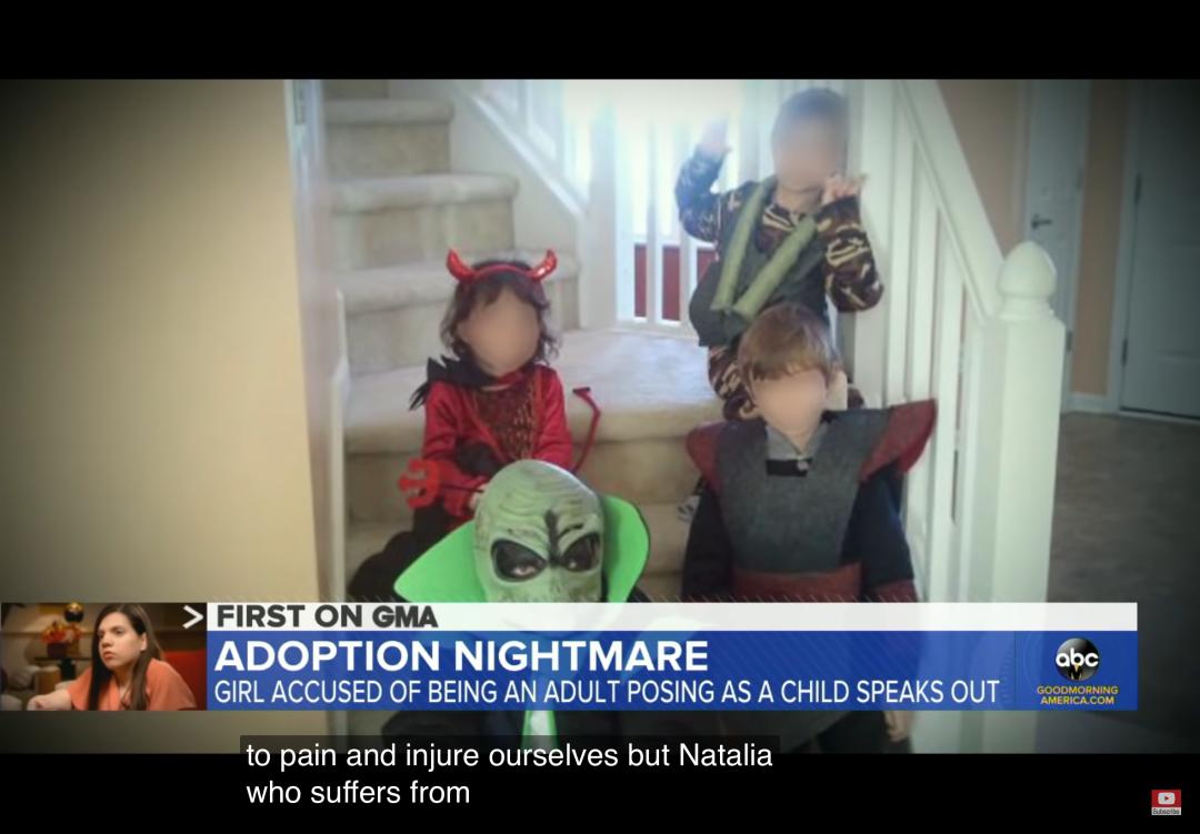 夫妇好心收养6岁女孩，发现竟是20岁侏儒假扮，还试图杀死他们