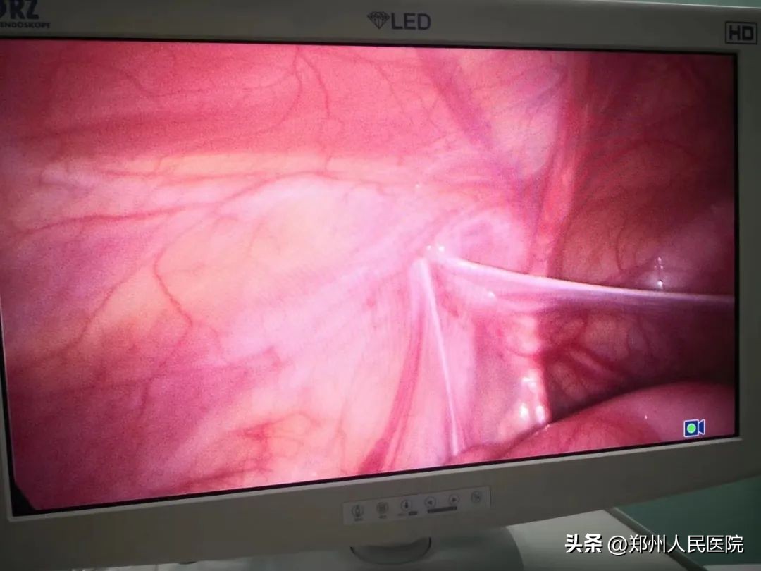 妈妈非常担心宝宝哭,妈妈总是为儿子着急焦虑