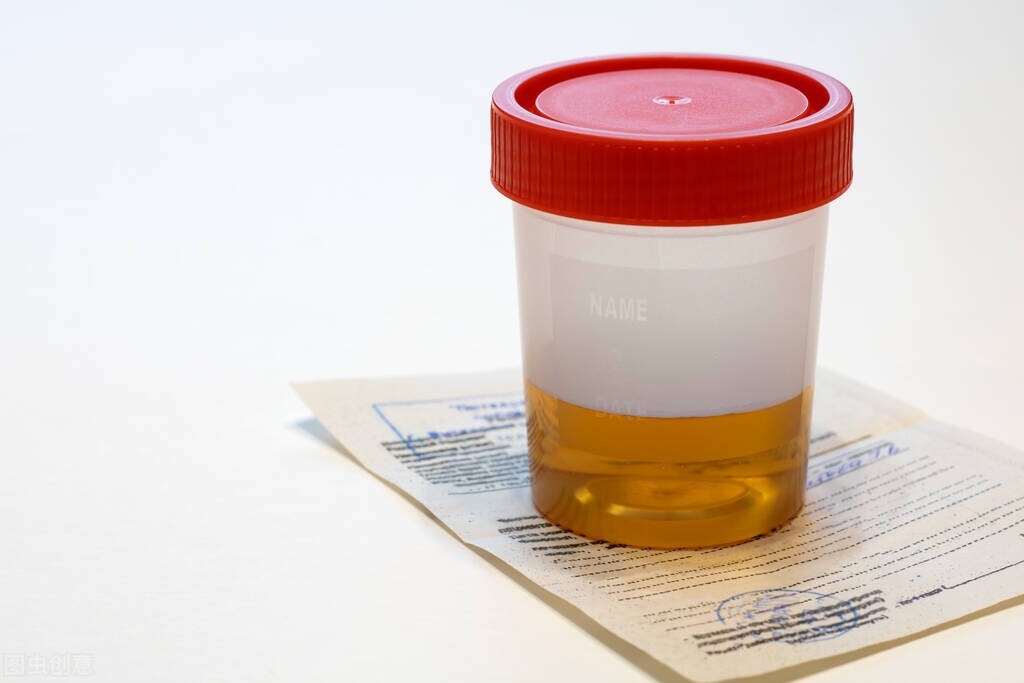 什么精子颜色正常,什么精子颜色是正常的