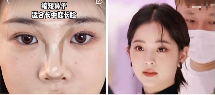 塌鼻子变美思路看这里,塌鼻梁怎么变漂亮