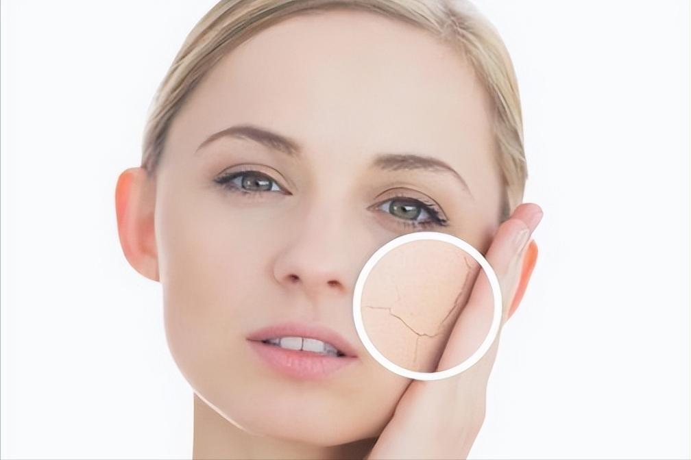 进行光子嫩肤有哪些误区,对光子嫩肤的误区