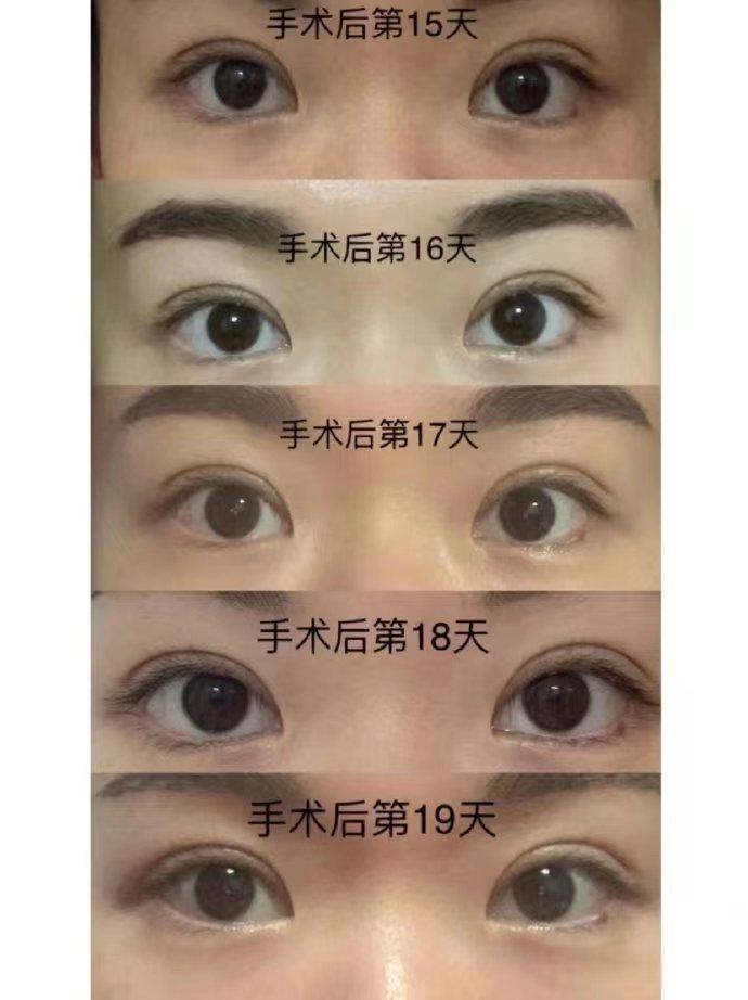 八大处医院杨喆抖音,八大处整形医院杨喆