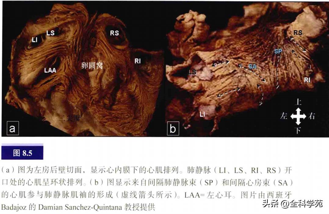 连接左心房的是肺静脉吗,左心房与肺静脉解剖