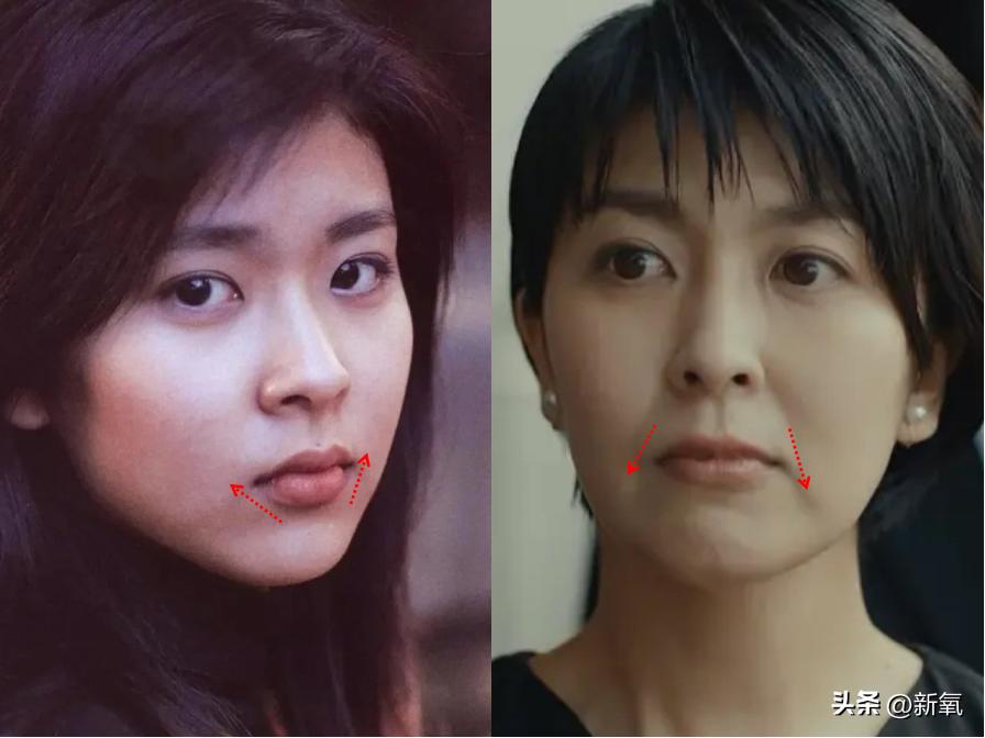 嘴唇薄变丰满,嘴唇变凸变丑怎么办