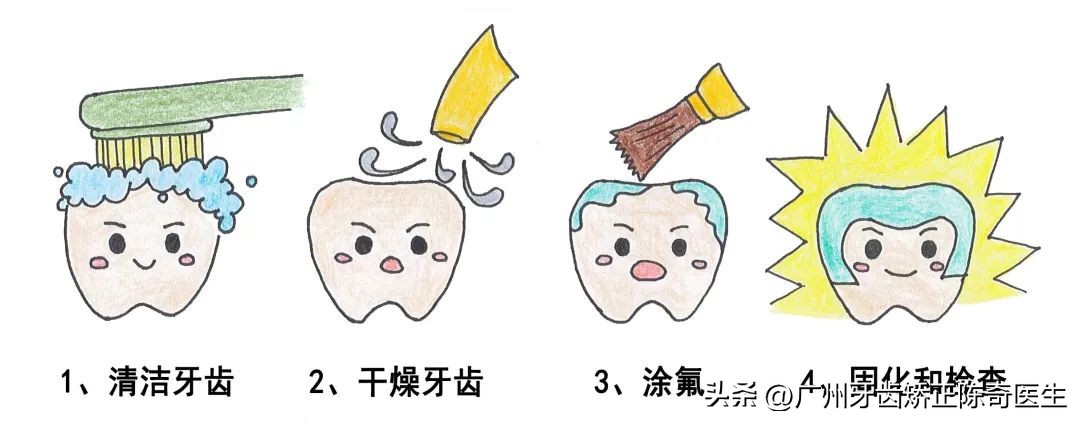 如何有效帮助孩子预防龋齿,预防儿童龋齿请家长们积极动起来