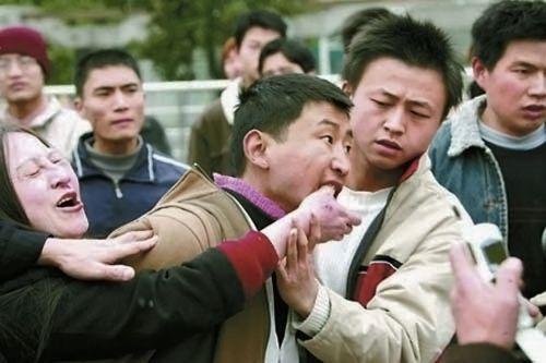 狗感染狂犬病一般多久发作,被狂犬病感染发作了能不能治好