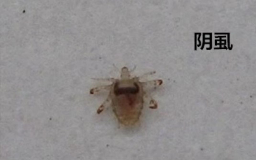 阴虱为何很少见了,阴虱为什么不叫阳虱