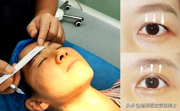 40岁的女人要做哪些简单医美,女人40做什么医美项目