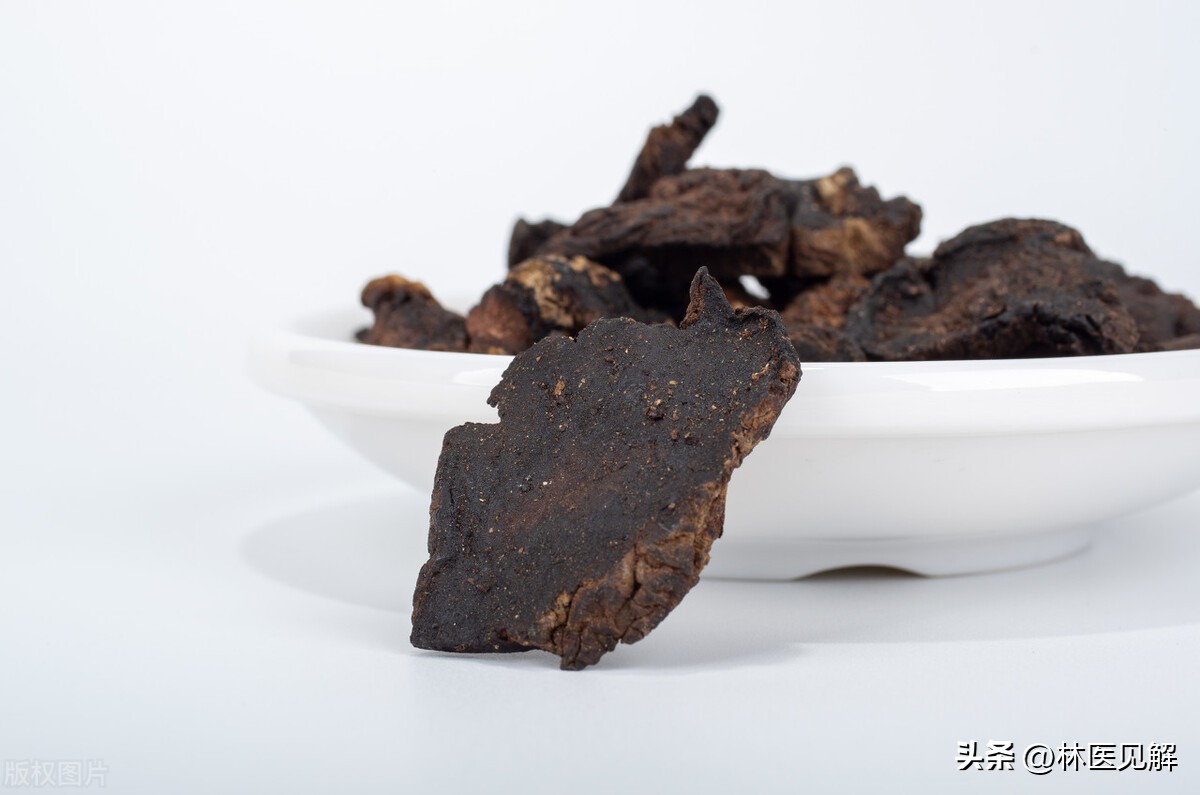 前列腺炎是肝经不通吗,前列腺炎不仅要补肾还要调肝