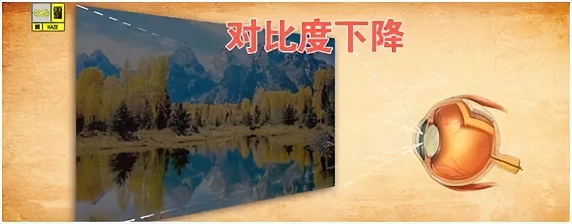 警惕四种致盲眼疾,致盲眼病的早期症状