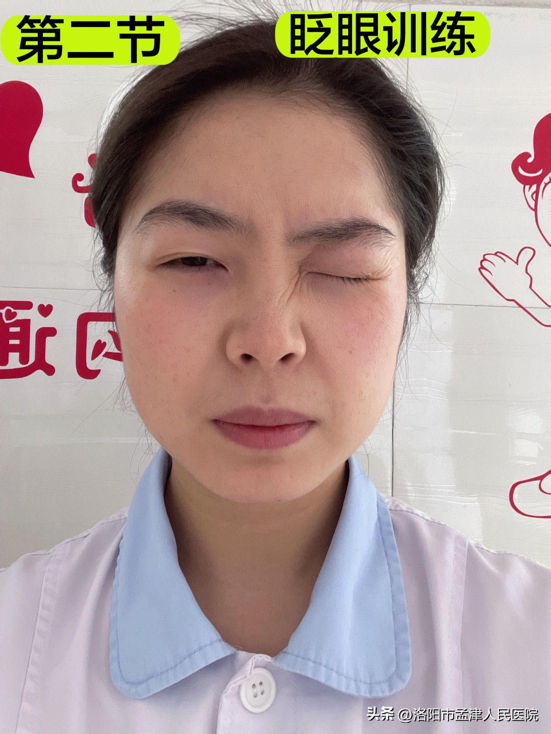 健康科普系列之偏瘫患者,面神经炎健康科普视频大赛作品