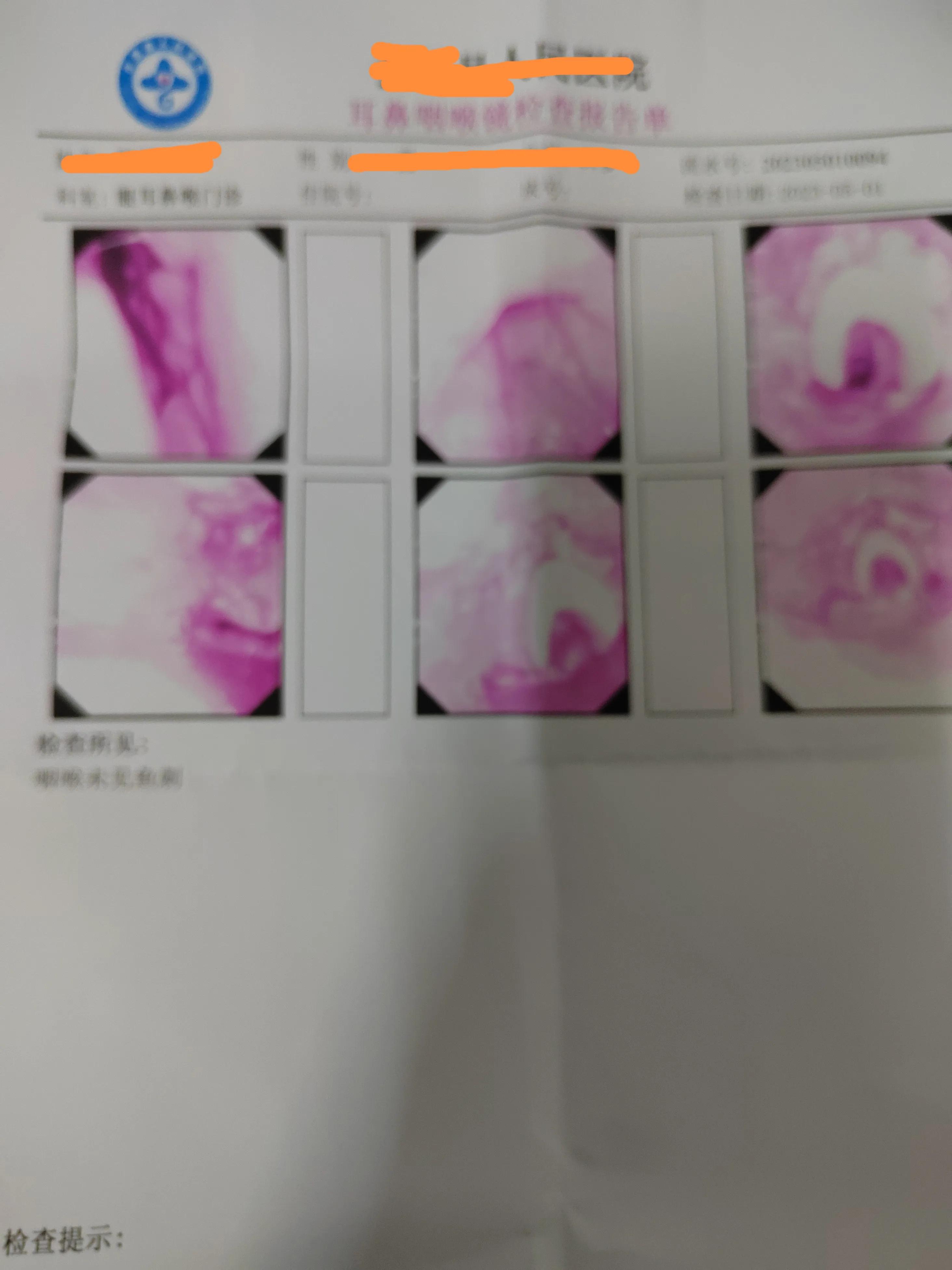 正常去医院拔鱼刺多少钱,到医院拔鱼刺得多少钱