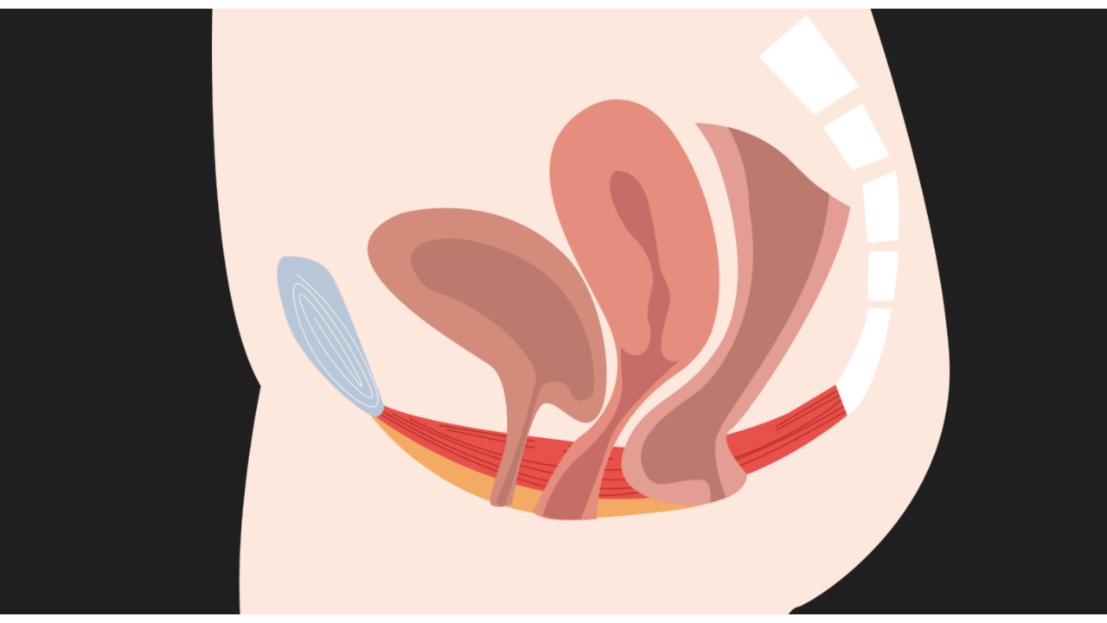 注意！性功能障碍不仅困扰男性，多数女性有苦说不出，该如何应对