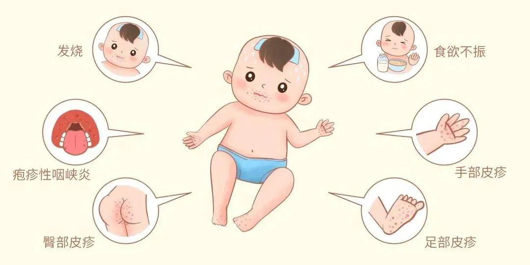 天气变得炎热是传染病的高发季,夏季肠道传染病高发这6点要记住