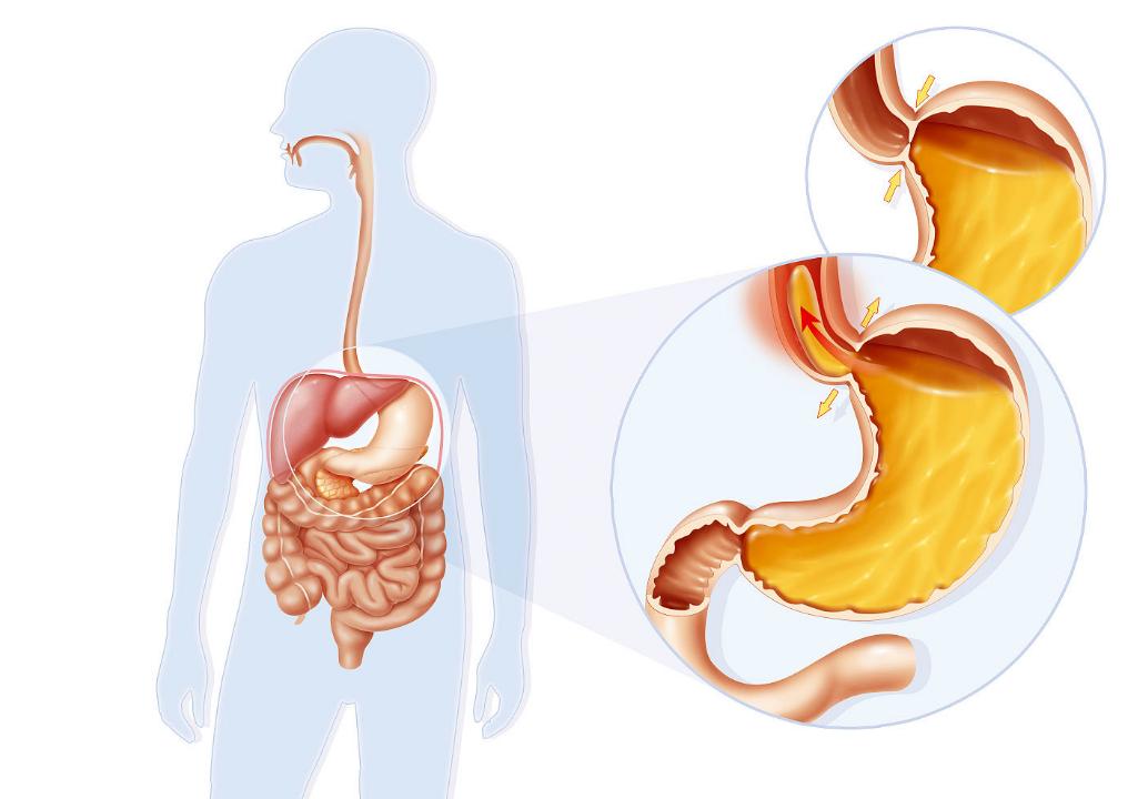 有哪些非处方药吃多了有危害,非处方药能长期吃吗