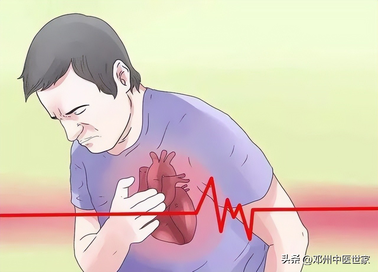 心梗打支架后的中医治疗,心梗消融术