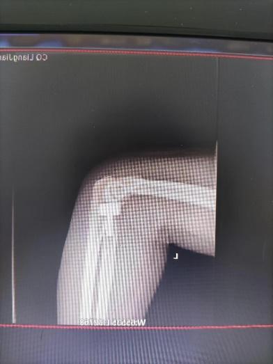 优秀!重庆两江新区中医院年度十佳技术出炉!