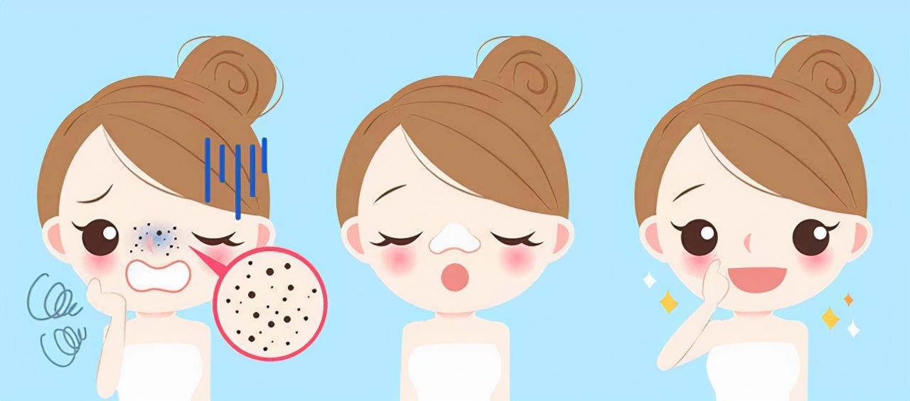 简单实用有效去黑头的方法,如何用简单的方法去黑头真实有效