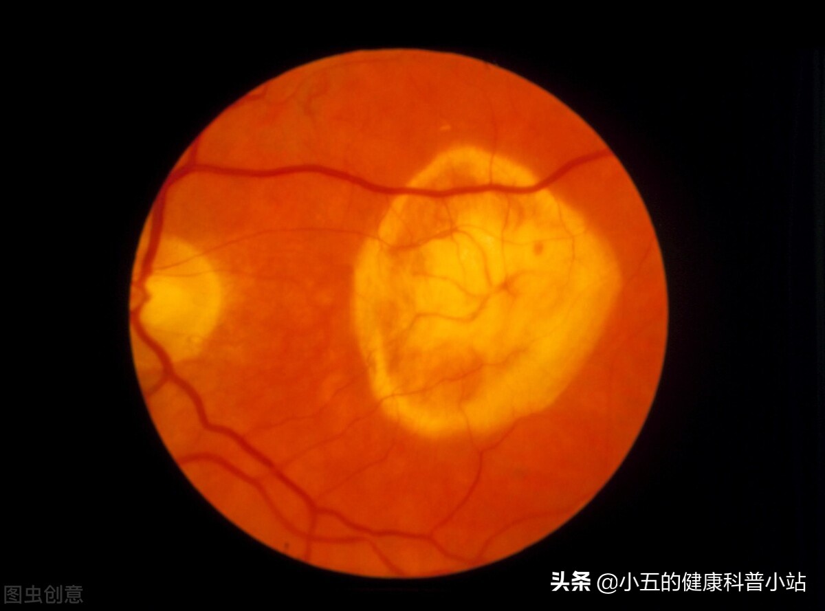 老年人视力减退吃什么,老年人保护视力吃什么维生素