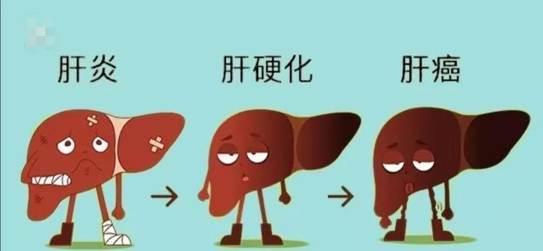 肝脏出现疾病原因有哪些,肝脏出现问题的前兆