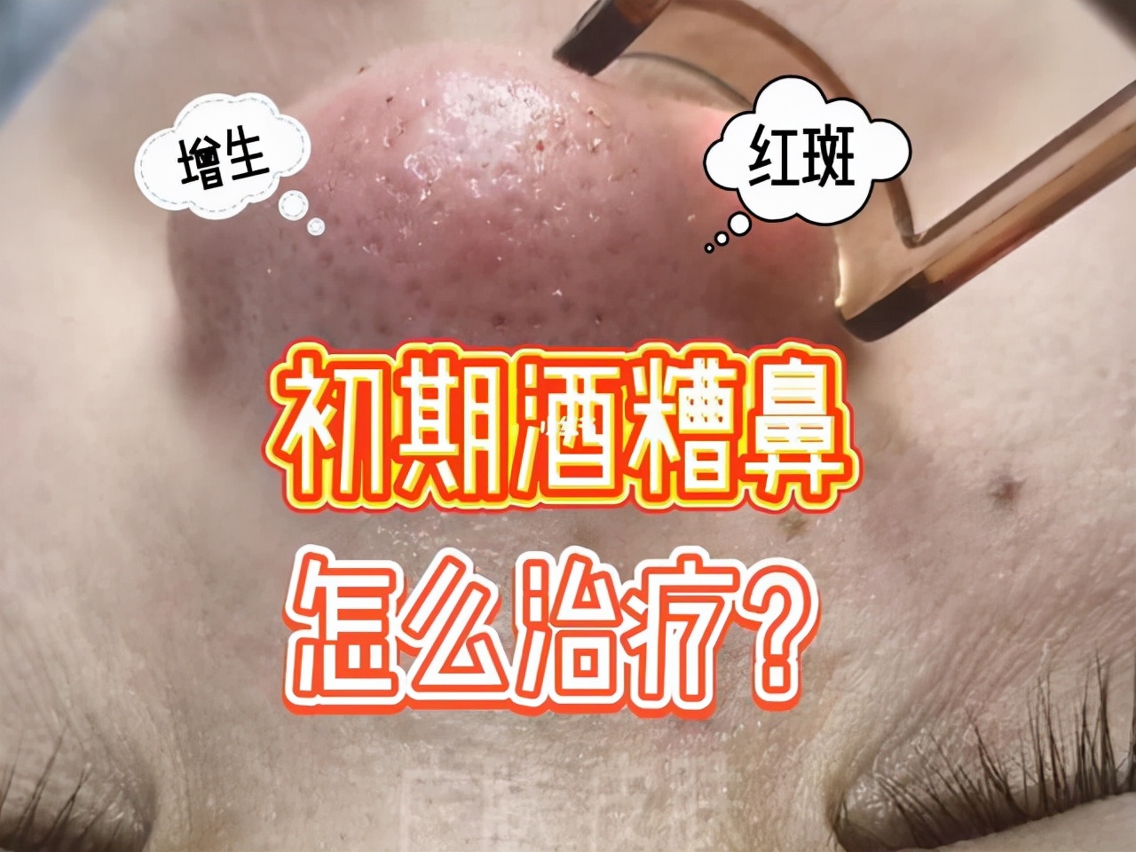 几块钱的甲硝唑栓有用吗,几块钱的甲硝唑片