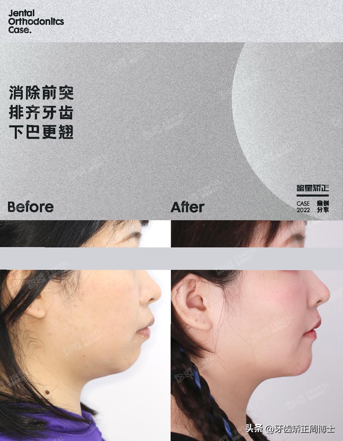 <html>
<head><title>502BadGateway</title></head>
<body>
<center><h1>502BadGateway</h1></center>
<hr><center>nginx</center>
</body>
</html>
<!--apaddingtodisableMSIEandChromefriendlyerrorpage-->
<!--apaddingtodisableMSIEandChromefriendlyerrorpage-->
<!--apaddingtodisableMSIEandChromefriendlyerrorpage-->
<!--apaddingtodisableMSIEandChromefriendlyerrorpage-->
<!--apaddingtodisableMSIEandChromefriendlyerrorpage-->
<!--apaddingtodisableMSIEandChromefriendlyerrorpage-->
