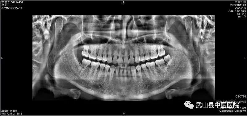 口腔科CBCT,口腔科cbct设备怎么选择