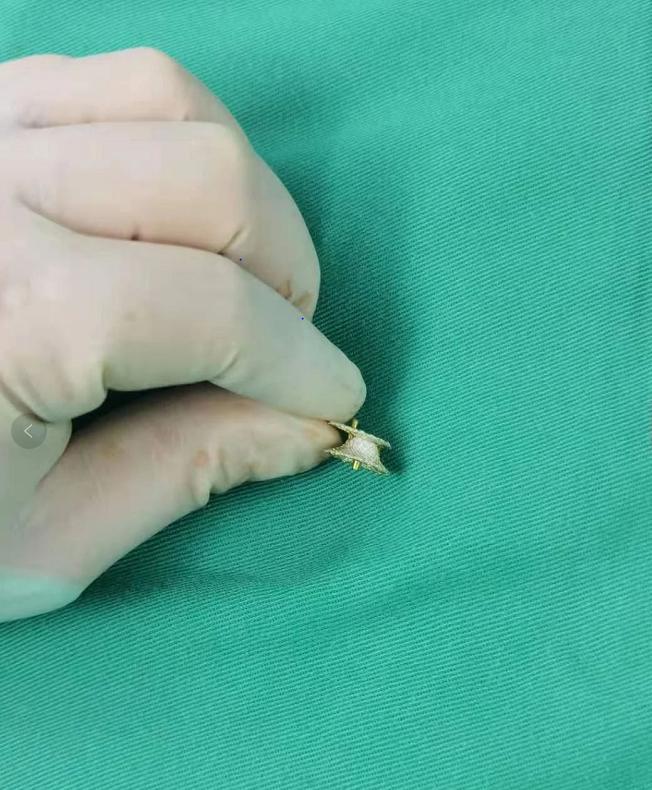 婴儿先天性心脏病怎么护理,婴儿先天性心脏病做什么手术好