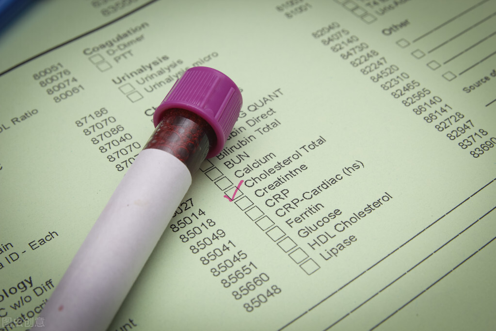 化验单有箭头是怎么回事,化验单有箭头是真的吗