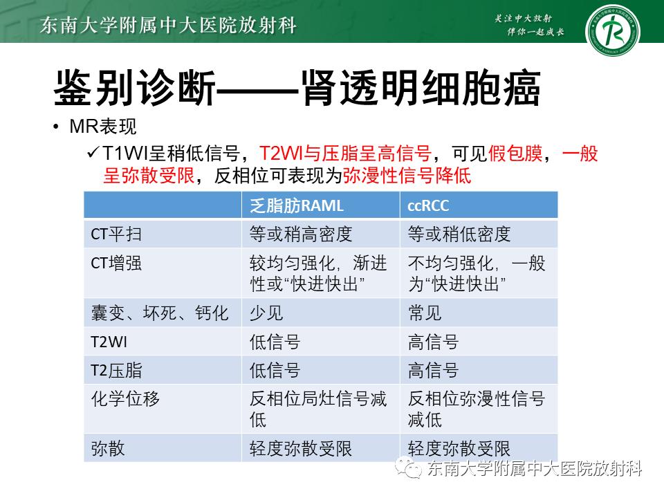 好文分享——《肾血管平滑肌脂肪瘤》