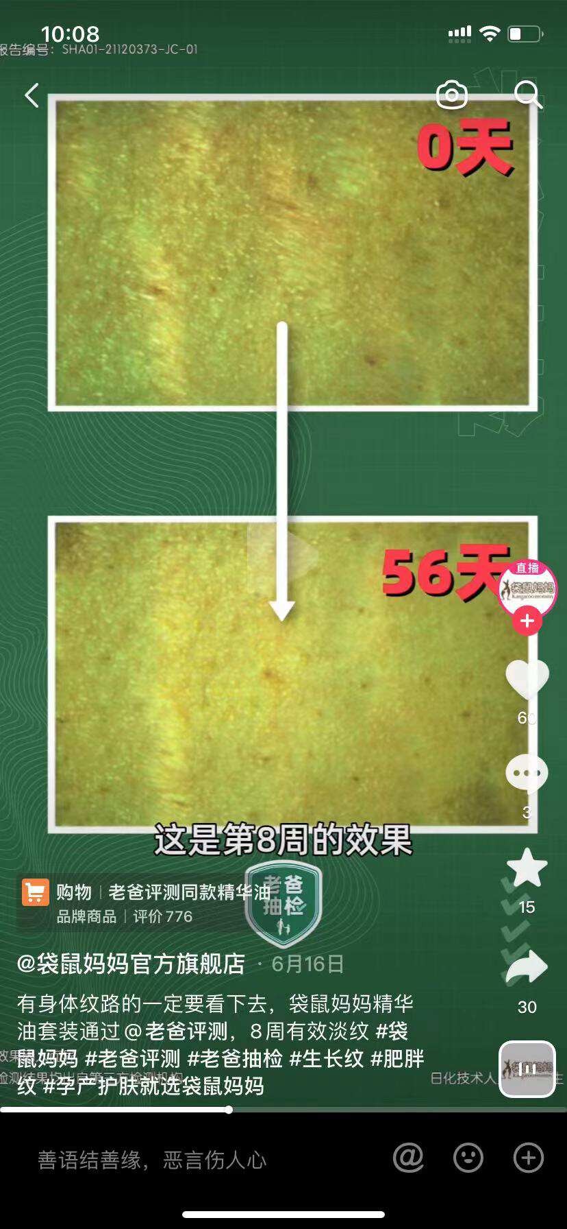 如何淡化腿上肥胖纹小窍门,腿上有肥胖纹怎么遮瑕