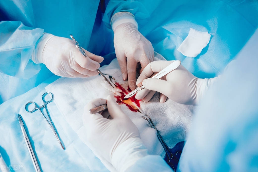 62岁大爷腹痛,60岁胆囊癌晚期