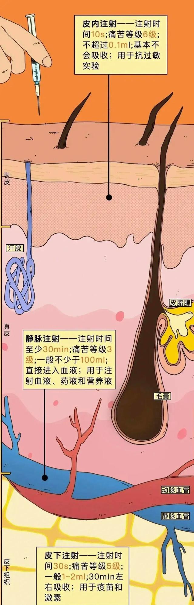 90后都打过的“屁股针”，究竟有多疼？一组漫画体验，你打过没