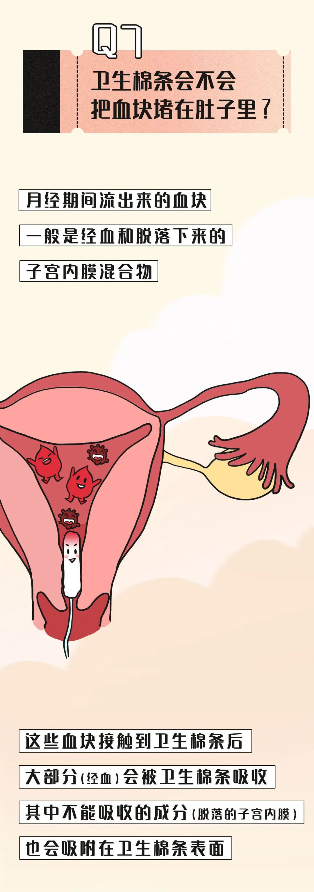 女生只要使用卫生棉条就不是处女了？或许和你想的不同！