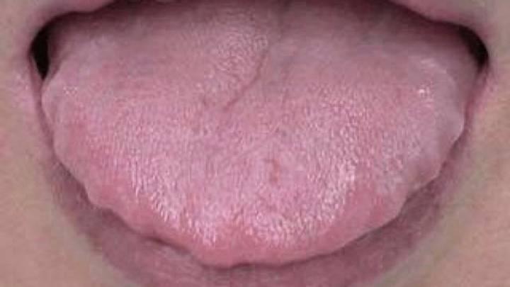 气虚，脾虚，湿气重，分享一味中成药，利水祛湿，补脾益气