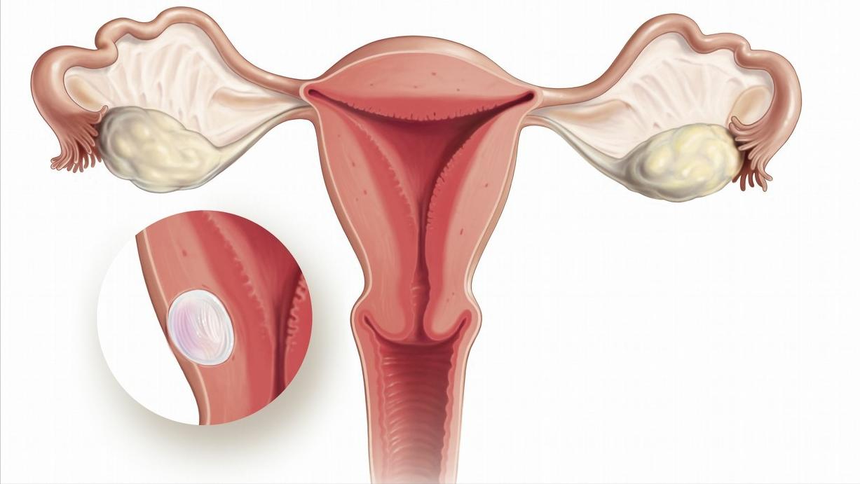 女人如果没有子宫会有什么影响,女性没有子宫和正常人有什么区别