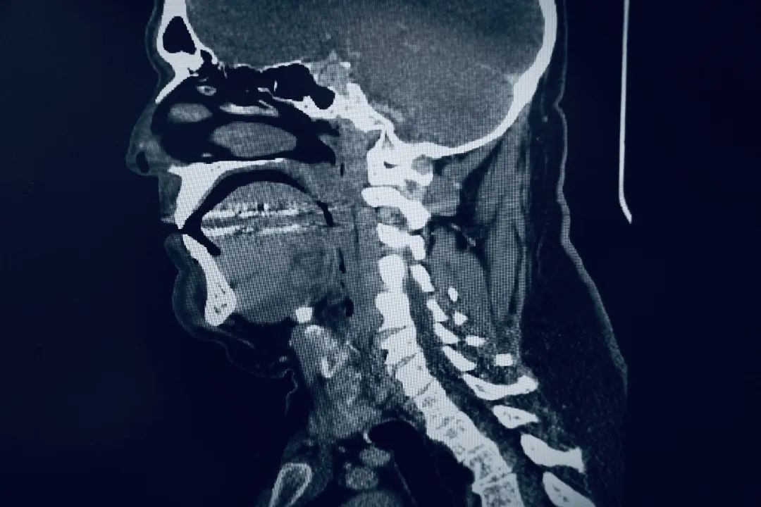 当新精英们不再想用健康换财富