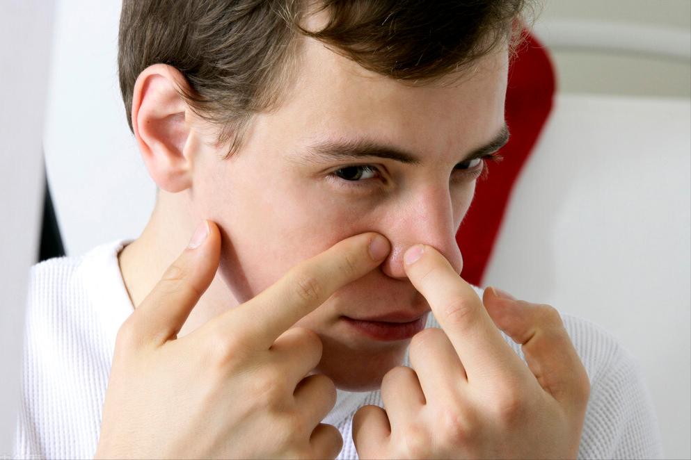 痘痘在脸上哪些位置代表什么,痘痘长在脸上不同位置代表什么