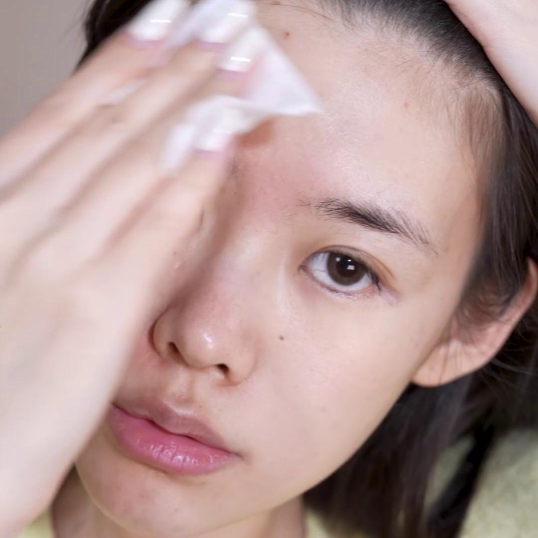 顽固闭口实战贴!让皮肤光光滑滑更健康~@抖音短视频